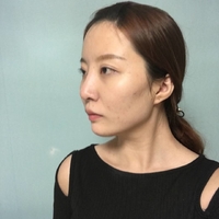 王良发整容技术如何?做磨骨瘦脸能找他吗?