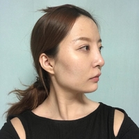 王良发整容技术如何?做磨骨瘦脸能找他吗?