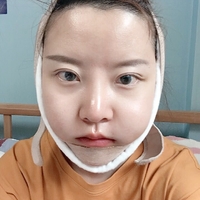 王良发整容技术如何?做磨骨瘦脸能找他吗?