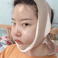 王良发整容技术如何?做磨骨瘦脸能找他吗?