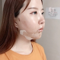 王良发整容技术如何?做磨骨瘦脸能找他吗?