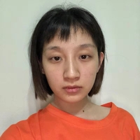 袁志玮肋软骨隆鼻的果如何?伊美尔鼻部整形专家是否名副其实