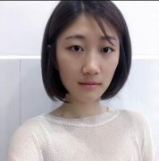 徐楠楠双眼皮案例对比：64天见证媚眼如丝~ width=