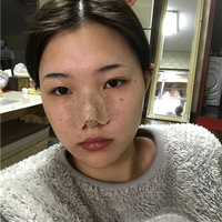 郑州虎珂整形医院怎么样?虎珂院长技术如何?