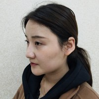 朱瑞峰鼻部手术技术如何?秃顶的他让我不是很放心