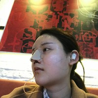 朱瑞峰鼻部手术技术如何?秃顶的他让我不是很放心