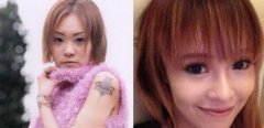 丁小芹整容前后对比图，惊叹美容整形的神奇 width=