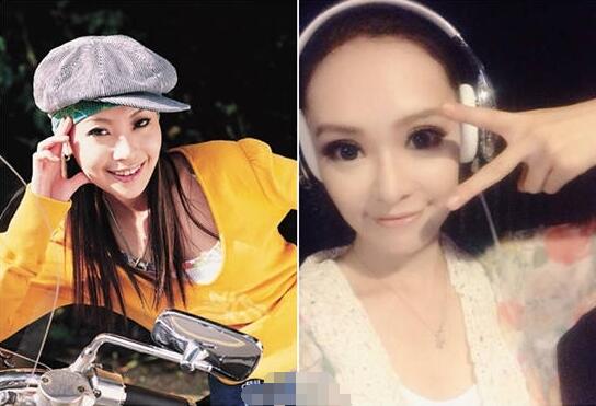丁小芹整容前后对比图，惊叹美容整形的神奇