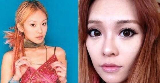 丁小芹整容前后对比图，惊叹美容整形的神奇