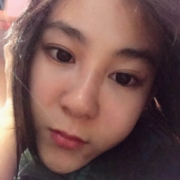 卢相勋植发技术如何?发际线太高让我很烦恼