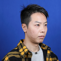 胡江伟做眼部手术果如何?历宁亲身案例为你解答