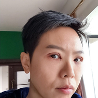 胡江伟做眼部手术果如何?历宁亲身案例为你解答