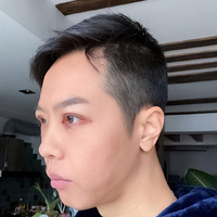 胡江伟做眼部手术果如何?历宁亲身案例为你解答