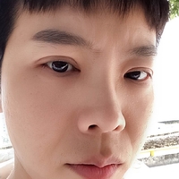 胡江伟做眼部手术果如何?历宁亲身案例为你解答