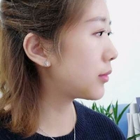 陈先才专家较擅长什么?垫下巴能行吗?