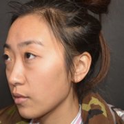 东田整形技术如何?就近选择东田整形靠谱吗? width=
