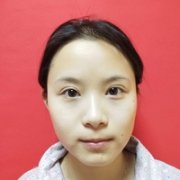 杭州新友好整形医院正规吗?技术如何? width=