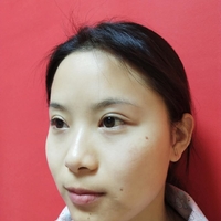 杭州新友好整形医院正规吗?技术如何?