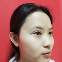 杭州新友好整形医院正规吗?技术如何?