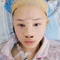 杭州新友好整形医院正规吗?技术如何?