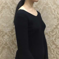 陈焕然在哪家医院?我想找他做隆胸整形