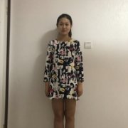 金永焕做吸脂手术果如何?这个他真的擅长吗? width=