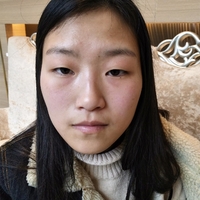 重庆真伊整形的重眼睑技术如何?能否让我拥有自然的双眼皮