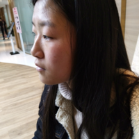 重庆真伊整形的重眼睑技术如何?能否让我拥有自然的双眼皮