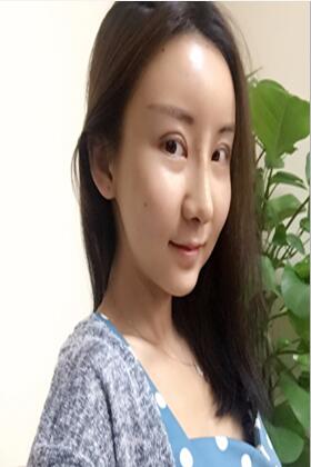 韩国隆鼻术果如何?真的比其他技术还厉害?