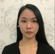 济南鹏爱医疗美容医院鼻翼肥大缩小对比案例：真人实例笔记体验 width=