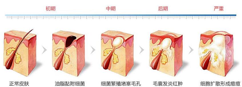 微针美容的大概费用是多少呢?影响的因素都有哪些?
