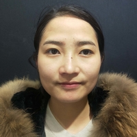 刘世铭院长实力如何?隆鼻+瘦脸案例分享