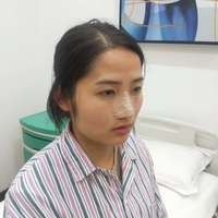 刘世铭院长实力如何?隆鼻+瘦脸案例分享