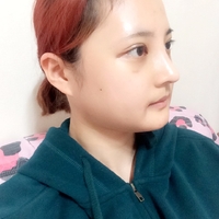 俞良钢下颌角整形技术如何?能改变我这脸型吗?