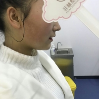 瑞兰2号多少钱一支?使用果如何?