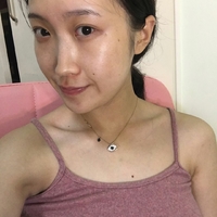 双美胶原蛋白隆鼻价格贵吗?双美胶原蛋白隆鼻果如何?