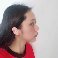 汕头伊丽莎白整形医院眼部手术项目如何?能改变一个人的精气神吗?