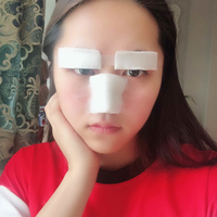 汕头伊丽莎白整形医院眼部手术项目如何?能改变一个人的精气神吗?