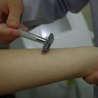 李常春医生激光脱毛技术如何?与毛茸茸的我说拜拜
