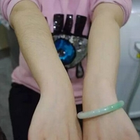 李常春医生激光脱毛技术如何?与毛茸茸的我说拜拜
