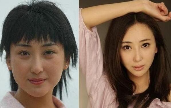 杜晓婷整容前后对比图，深扒其变化