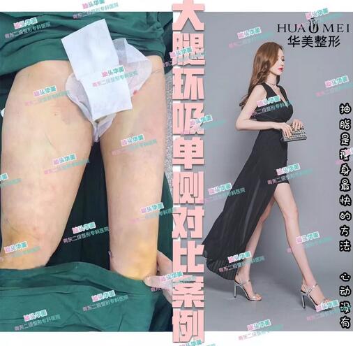 “看着瘦，脱了衣服，身上竟然全是赘肉……”怎么速破？