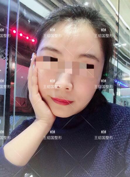 【王绍国面部加减法案例】——美的积极循环~