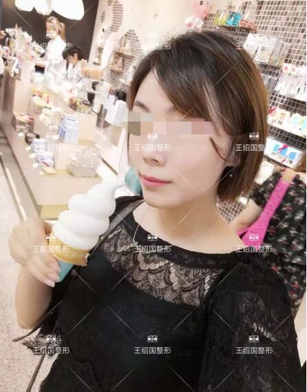 【王绍国面部加减法案例】——美的积极循环~