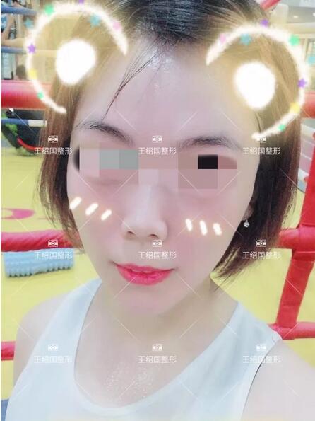 【王绍国面部加减法案例】——美的积极循环~