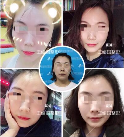 【王绍国面部加减法案例】——美的积极循环~