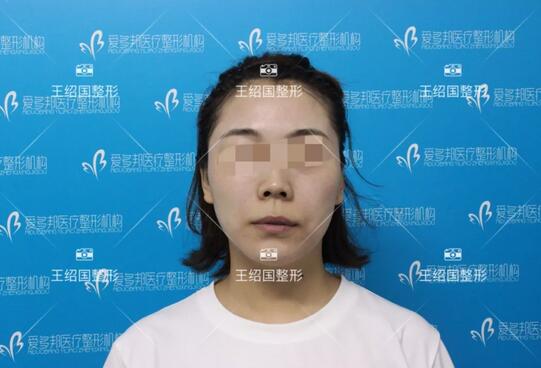 【王绍国面部加减法案例】——美的积极循环~