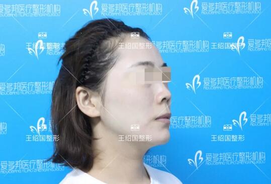 【王绍国面部加减法案例】——美的积极循环~