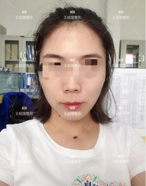 【王绍国面部加减法案例】——美的积极循环~
