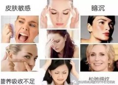 据说，90%的人难逃3大肌肤困扰~ width=